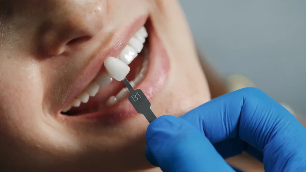 Zirkonyum dis kaplamasi nerede yaptirilir