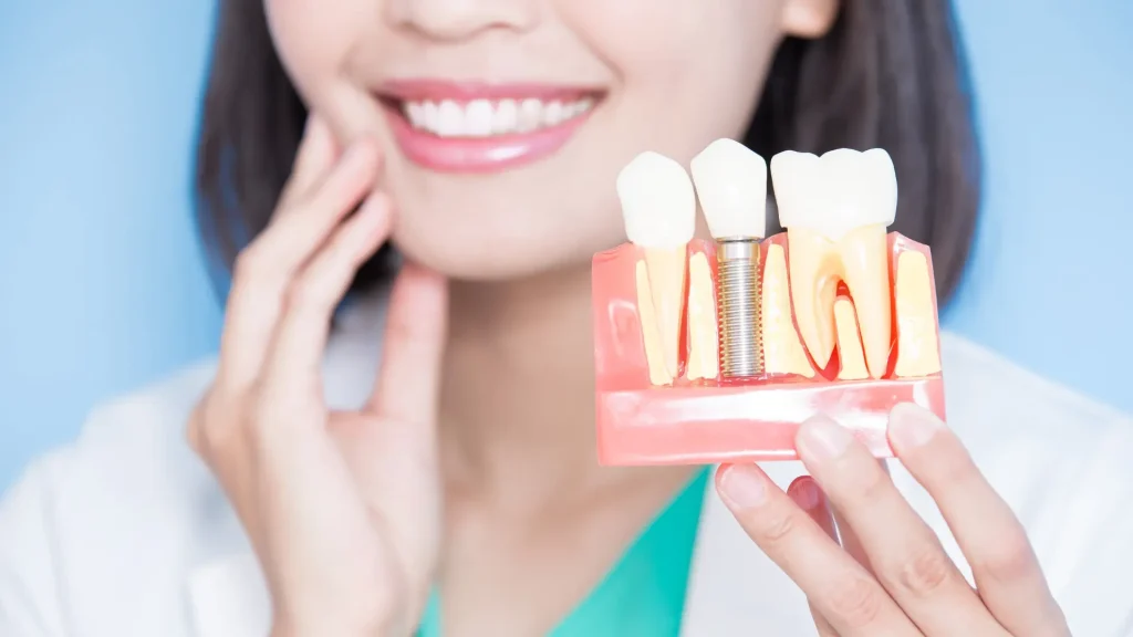 Alt Çene İmplant Uygulaması Nedir?