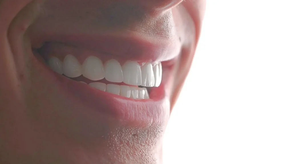 Zirkonyum Kaplama nasıl görünür