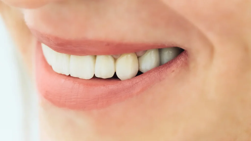 Zirkonyum Kaplama Nasıl Yapılır?