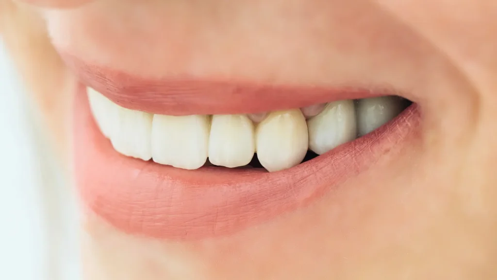 Zirkonyum Diş Kaplama