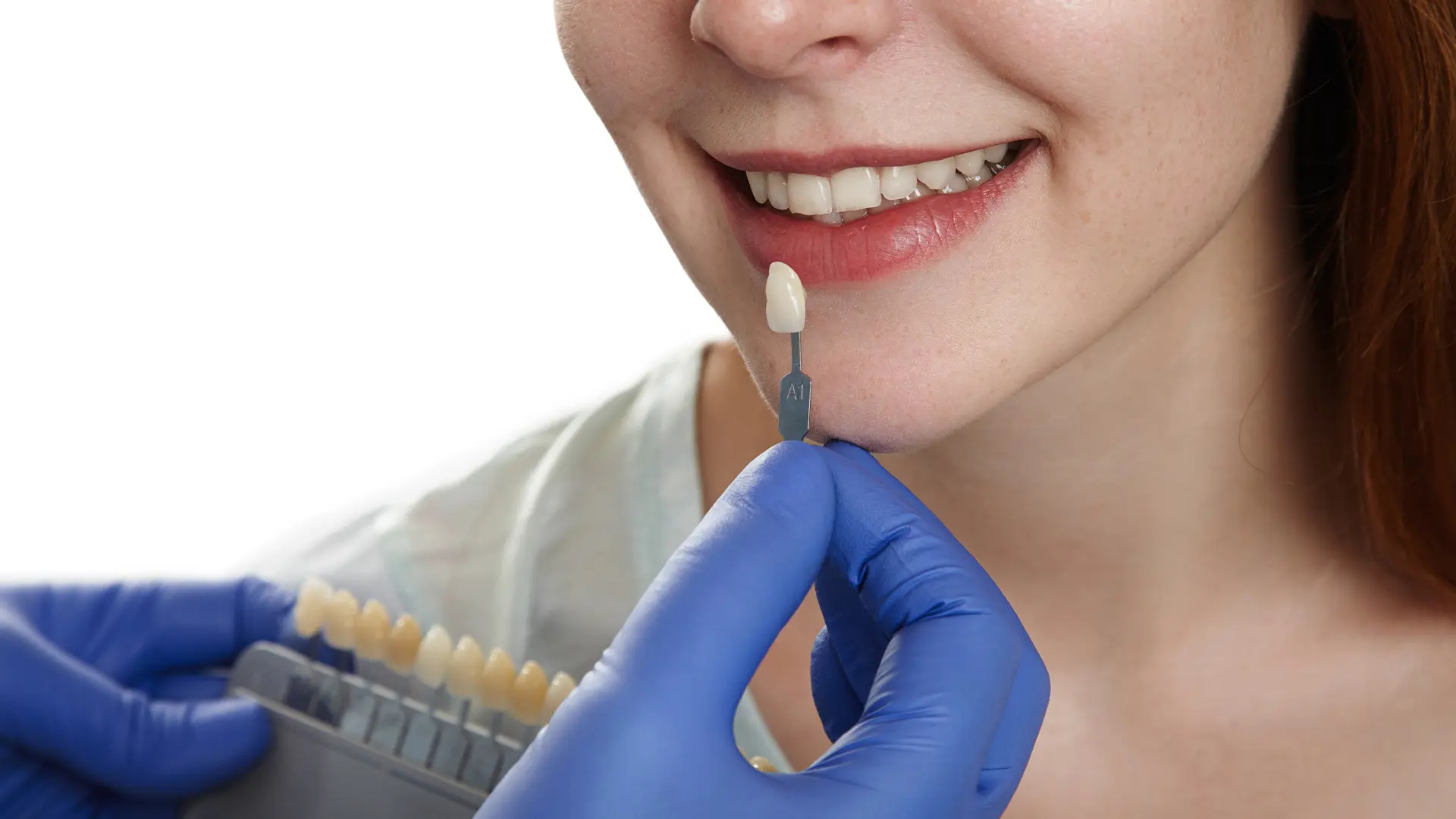 Porselen Kron Tedavisi