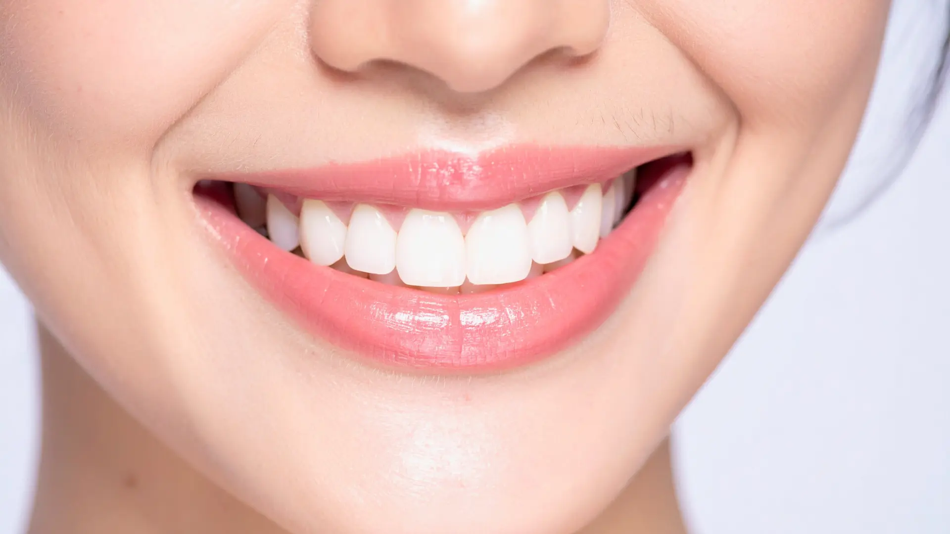 Gummy Smile (Diş Eti Gülüşü) Nedir ve Nasıl Tedavi Edilir?